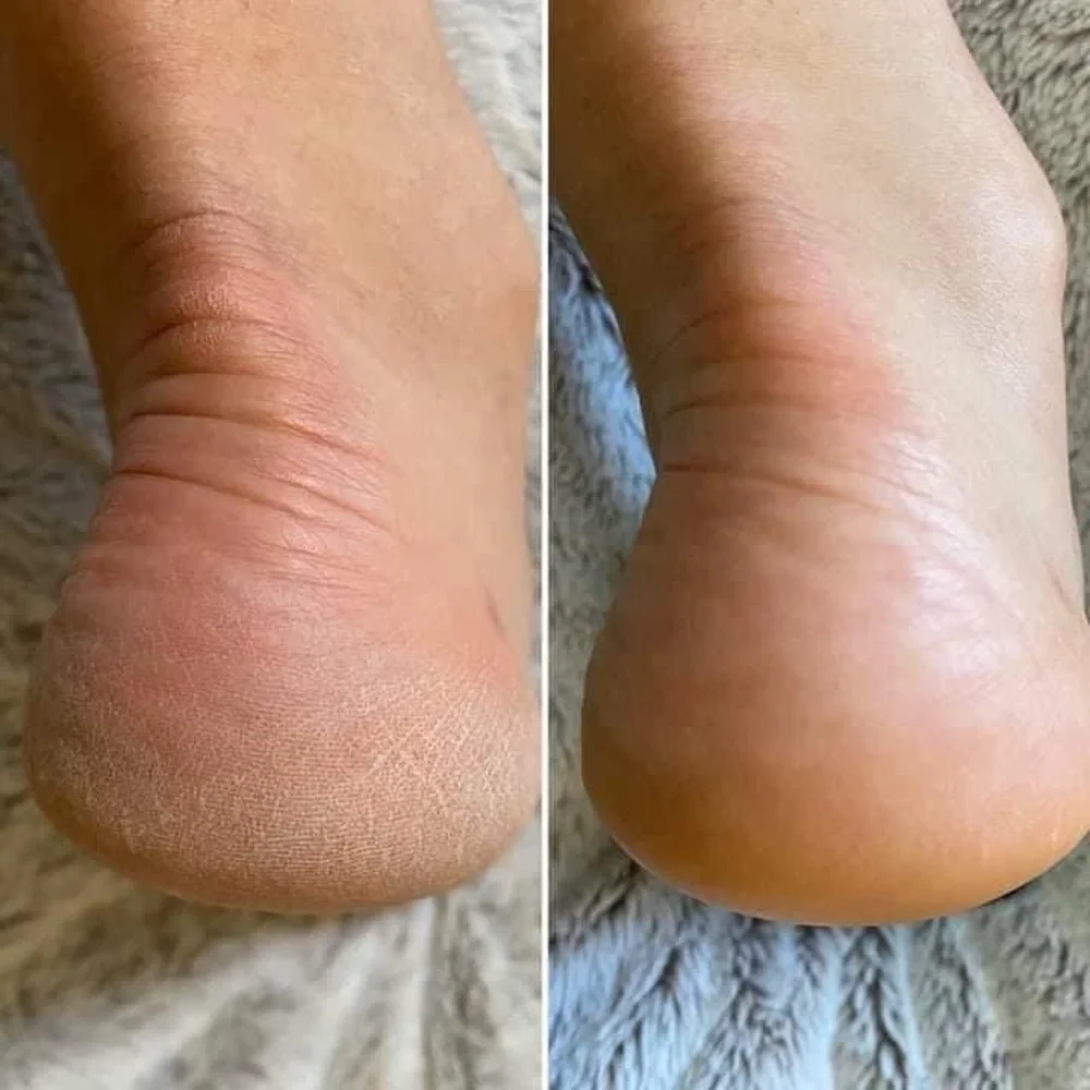 Pedicure in a bottle - Picture 4 of 9